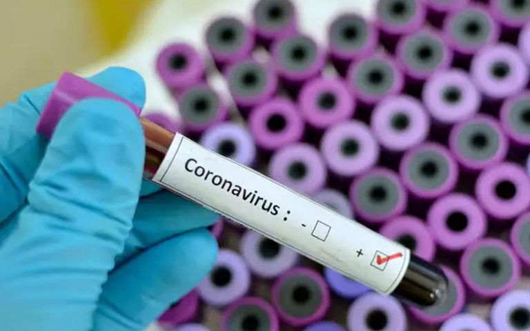 ಕೊಂದುಬಿಡು ಕೊರೋನಾ, ಹಸಿವಿನಿಂದ ಸತ್ತೆನೆಂಬ ಅಪವಾದ ನನ್ನ ದೇಶಕ್ಕೆ ಬರದಿರಲಿ – ಪುನೀತ್‌ ಅಪ್ಪು