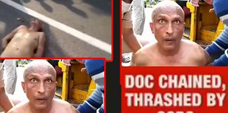 Cops tie hands and beat doctor dr sudhakar who complains about N-95 mask shortage