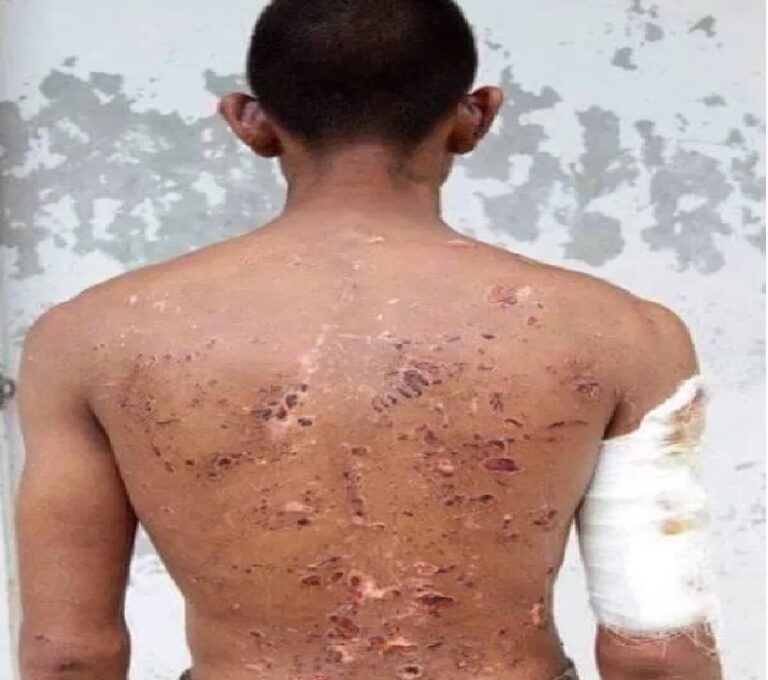 ಫ್ಯಾಕ್ಟ್ ಚೆಕ್: ಈ ಚಿತ್ರ ಭಾರತ-ಚೀನಾ ಘರ್ಷಣೆಯಲ್ಲಿ ಗಾಯಗೊಂಡ ಭಾರತೀಯ ಯೋಧನದ್ದೇ ?