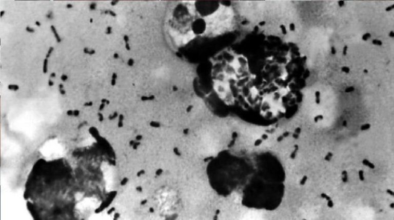 ಬುಬೋನಿಕ್ ಪ್ಲೇಗ್: ಚೀನಾದಲ್ಲಿ ಪತ್ತೆಯಾದ ಮತ್ತೊಂದು ಸೋಂಕು