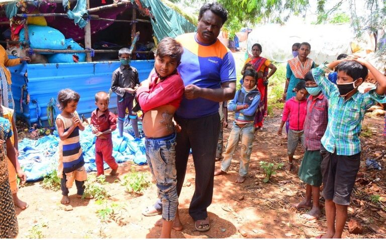 ಎಳವ ಜೋಗರ, ಗುಡಿಸಲಿಗೆ ಬೆಂಕಿ: ಅನಾಹುತದಿಂದ ಪಾರಾದ ಕುಟುಂಬವನ್ನು ಒಕ್ಕಲೆಬ್ಬಿಸುವ ಹುನ್ನಾರ