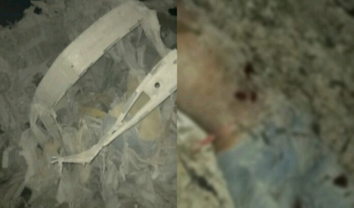 ಭೂಕಂಪ ಅಲ್ಲ, ಡೈನಾಮೈಟ್ ಸ್ಫೋಟ! - ಶಿವಮೊಗ್ಗದಲ್ಲಿ 15 ಕಾರ್ಮಿಕರ ದುರ್ಮರಣ