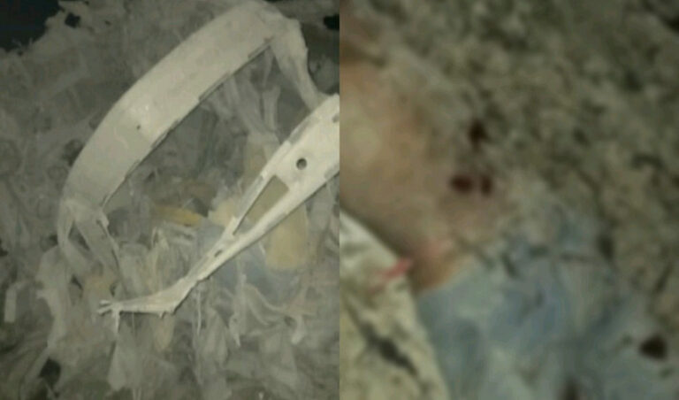 ಭೂಕಂಪ ಅಲ್ಲ, ಡೈನಾಮೈಟ್ ಸ್ಫೋಟ! - ಶಿವಮೊಗ್ಗದಲ್ಲಿ 15 ಕಾರ್ಮಿಕರ ದುರ್ಮರಣ