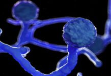 ರಾಜಸ್ಥಾನದಲ್ಲಿ ಬ್ಲಾಕ್ ಫಂಗಸ್‌ ಸಾಂಕ್ರಾಮಿಕ ರೋಗ ಎಂದು ಘೋಷಣೆ