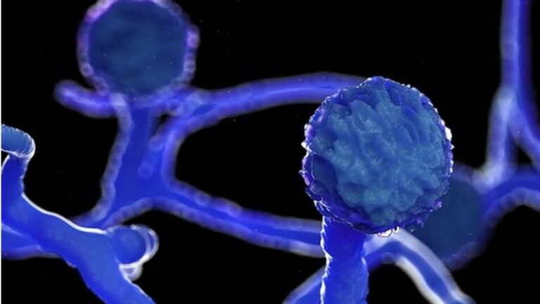 ಬ್ಲ್ಯಾಕ್ ಫಂಗಸ್: ವಾಸ್ತವವೇನು? ವೈದ್ಯರೇನು ಹೇಳುತ್ತಿದ್ದಾರೆ?: ಡಾ. ವಾಸು