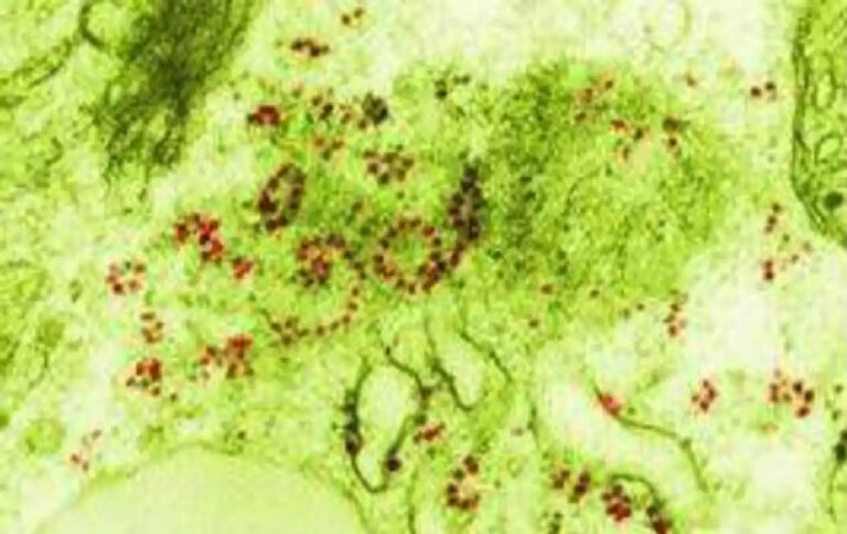 ಮಧ್ಯಪ್ರದೇಶ: ಕೊರೊನಾದಿಂದ ಗುಣಮುಖರಾದ ವ್ಯಕ್ತಿಯಲ್ಲಿ ಗ್ರೀನ್​ ಫಂಗಸ್​ ಪತ್ತೆ