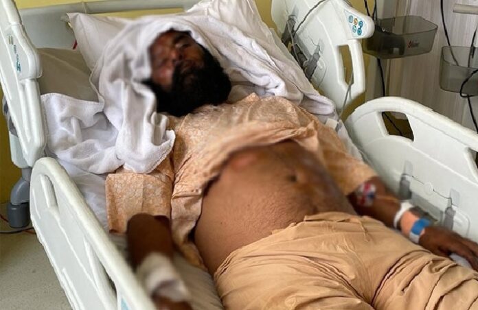 ರೈತರ ಮೇಲೆ ಹರಿದ ಕಾರನ್ನು ಅಜಯ್ ಮಿಶ್ರಾ ಪುತ್ರ ಆಶೀಶ್ ಚಲಾಯಿಸುತ್ತಿದ್ದರು: ಗಾಯಾಳು ರೈತ ಮುಖಂಡ