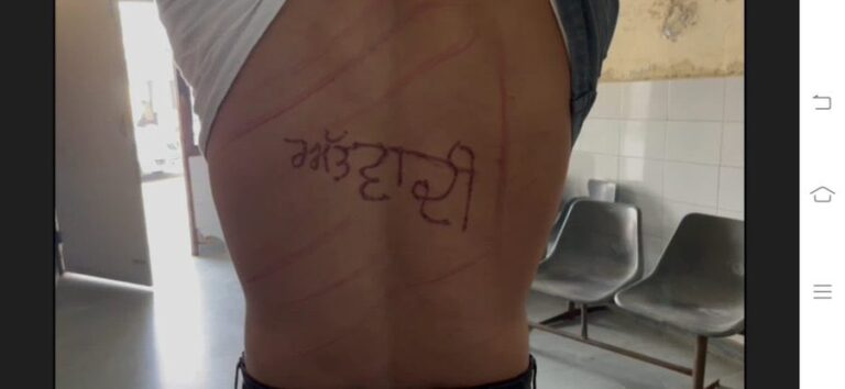 ಬೆನ್ನಿನ ಮೇಲೆ ‘ಭಯೋತ್ಪಾದಕ’ ಎಂದು ಕೊರೆದು ಪೊಲೀಸರಿಂದ ಚಿತ್ರಹಿಂಸೆ: ವಿಚಾರಣಾಧೀನ ಕೈದಿಯ ಆರೋಪ
