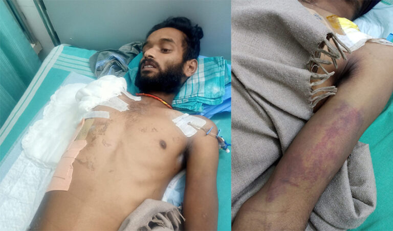 ಬೆಂಗಳೂರು: ಯುವಕನ ಬಲಗೈ ಕಟ್ ಆಗುವಂತೆ ಹಲ್ಲೆ ನಡೆಸಿದ್ದ ಮೂವರು ಪೊಲೀಸರ ಅಮಾನತು