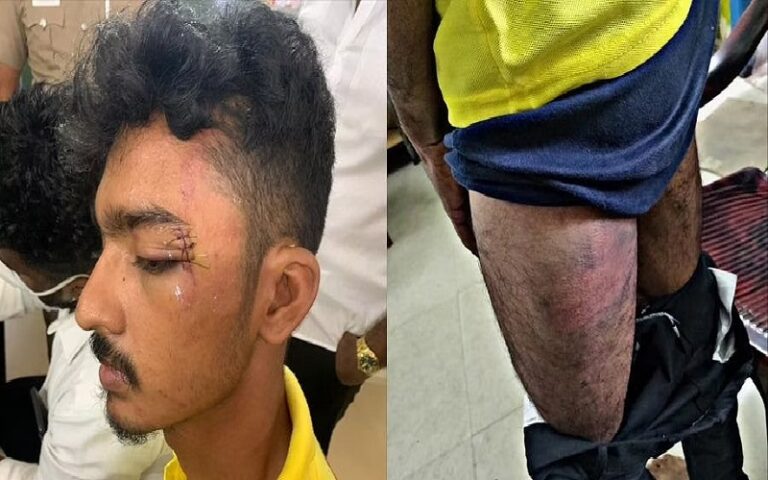 ತಮಿಳುನಾಡು: ವಿದ್ಯಾರ್ಥಿ ಮೇಲೆ ಪೊಲೀಸ್ ದೌರ್ಜನ್ಯ, 9 ಮಂದಿ ಪೊಲೀಸರ ಮೇಲೆ FIR