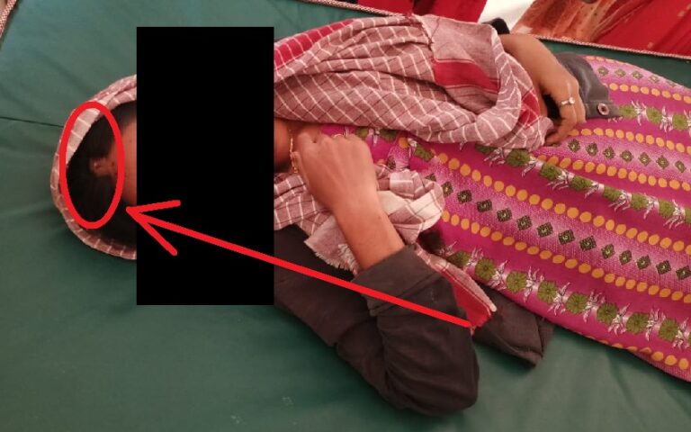 ಮಂಡ್ಯ: ಅಂಗಡಿ ಮುಂದೆ ದಲಿತರು ನಡೆದಾಡಿದ್ದಕ್ಕೆ ಮೈಲಿಗೆಯಾಯಿತೆಂದು ಸವರ್ಣೀಯರಿಂದ ಹಲ್ಲೆ