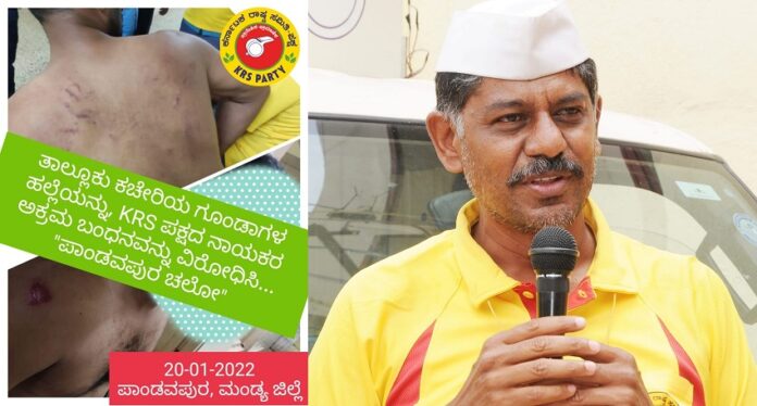 ಕಾರ್ಯಕರ್ತರ ಮೇಲಿನ ಹಲ್ಲೆ ಖಂಡಿಸಿ KRS ಪಕ್ಷದಿಂದ ‘ಪಾಂಡವಪುರ ಚಲೋ’ | Naanu Gauri