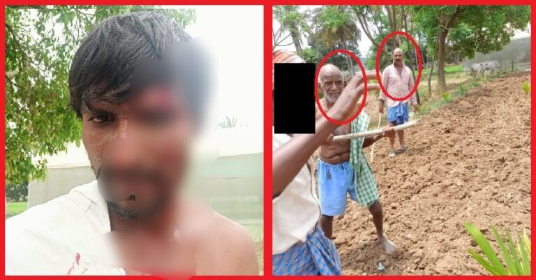 ಹಾಸನ: ಗುರಾಯಿಸಿ ನೋಡಿದ್ದಾಗಿ ಆರೋಪಿಸಿ ದಲಿತ ಯುವಕನಿಗೆ ಮಾರಣಾಂತಿಕ ಹಲ್ಲೆ ನಡೆಸಿದ ಸವರ್ಣೀಯರು | Naanu Gauri