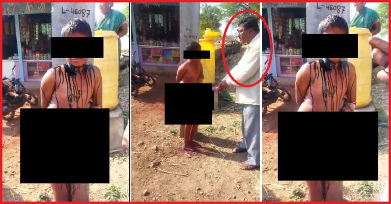 ವಿಜಯಪುರ: 12 ವರ್ಷದ ಬಾಲಕನನ್ನು ಬೆತ್ತಲೆಗೊಳಿಸಿ ಚಿತ್ರ ಹಿಂಸೆ; ಇನ್ನೂ ‘ಪೋಕ್ಸೋ’ ದಾಖಲಿಸದ ಪೊಲೀಸರು!