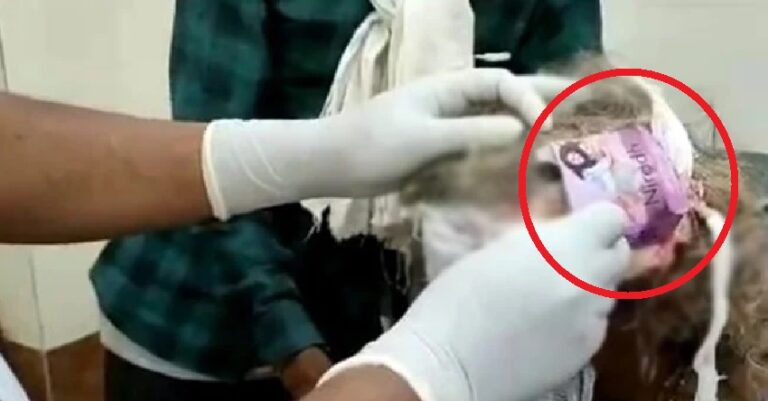 ಮಧ್ಯಪ್ರದೇಶ: ಗಾಯಕ್ಕೆ ‘ಕಾಂಡೋಮ್‌ನ ಕವರ್‌’ ಇಟ್ಟು ಬ್ಯಾಂಡೇಜ್ ಮಾಡಿದ ಆರೋಗ್ಯ ಕೇಂದ್ರದ ಸಿಬ್ಬಂದಿ | Naanu Gauri