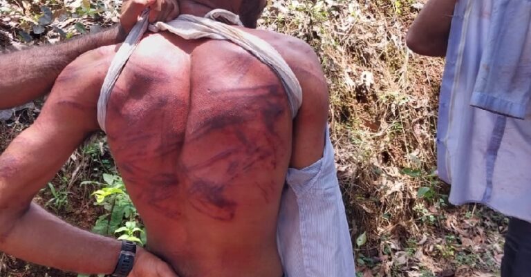 ದಕ್ಷಿಣ ಕನ್ನಡ ಅನೈತಿಕ ಪೊಲೀಸ್‌ಗಿರಿ: ಸಹಪಾಠಿಯೊಂದಿಗೆ ಮಾತನಾಡಿದ್ದಾನೆ ಎಂದು ಆರೋಪಿಸಿ ವಿದ್ಯಾರ್ಥಿಗೆ ಥಳಿತ