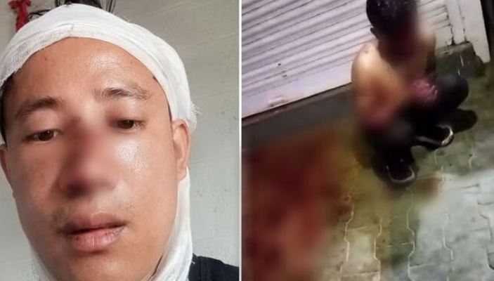 ಬೆಂಗಳೂರು: ಸಿಕ್ಕಿಂ ಮೂಲದ ಯುವಕನಿಗೆ ”ಚೈನೀಸ್” ಎಂದು ಕರೆದು ಹಲ್ಲೆ