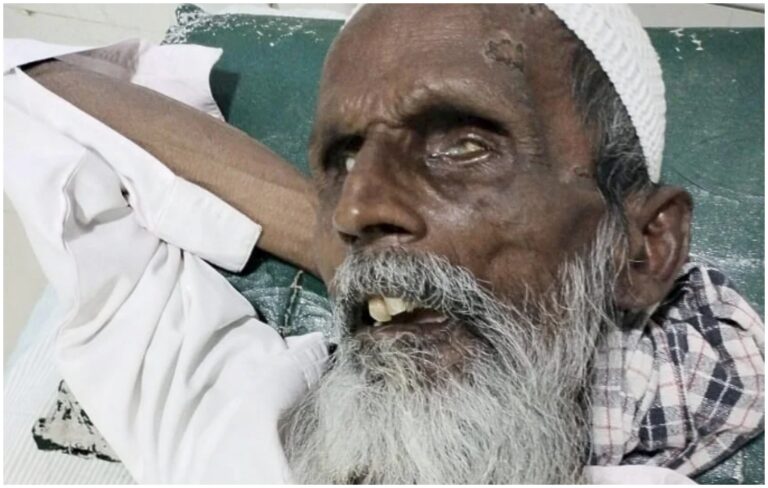 ಗಂಗಾವತಿ: ‘ಜೈ ಶ್ರೀರಾಮ್’ ಹೇಳುವಂತೆ ಒತ್ತಾಯಿಸಿ ಅಂಧ ಮುಸ್ಲಿಂ ವೃದ್ಧನ ಮೇಲೆ ಹಲ್ಲೆ