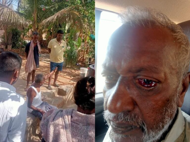 ಧ್ವನಿವರ್ಧಕ ಶಬ್ಧ ಕಡಿಮೆ ಮಾಡುವಂತೆ ಕೇಳಿದ್ದಕ್ಕೆ ಹಲ್ಲೆ; ಹಿರಿಯ ಸಾಹಿತಿ ಕೋಟಿಗಾನಹಳ್ಳಿ ರಾಮಯ್ಯ ಆಸ್ಪತ್ರೆಗೆ ದಾಖಲು