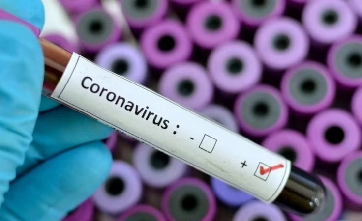 ಬಿಜೆಪಿ ಅವಧಿಯ ಕೋವಿಡ್ ಹಗರಣ : ಮೊದಲ ಎಫ್‌ಐಆರ್ ದಾಖಲು