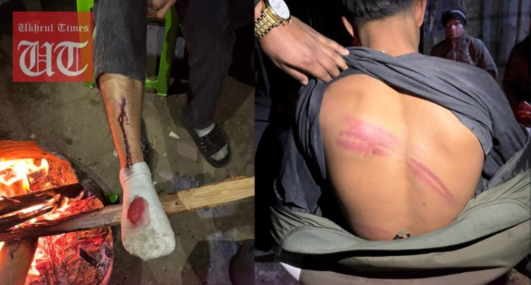 ಮುಸ್ಲಿಂ ಯುವಕನಿಗೆ ಥಳಿಸಿ, ಹಂದಿ ಮಾಂಸ ತಿನ್ನುವಂತೆ ಒತ್ತಾಯ