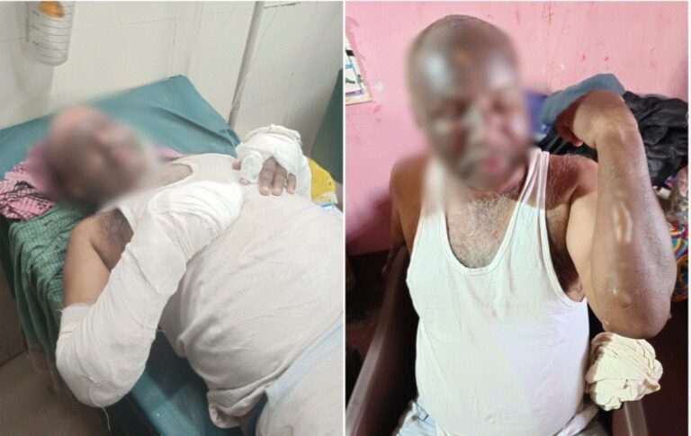 ಮದ್ದೂರು | ಗಾರ್ಮೆಂಟ್ಸ್ ಕಾರ್ಖಾನೆಯಲ್ಲಿ ಕೆಮಿಕಲ್ ಸ್ಫೋಟ : ಕಾರ್ಮಿಕರು ಆಸ್ಪತ್ರೆಗೆ ದಾಖಲು