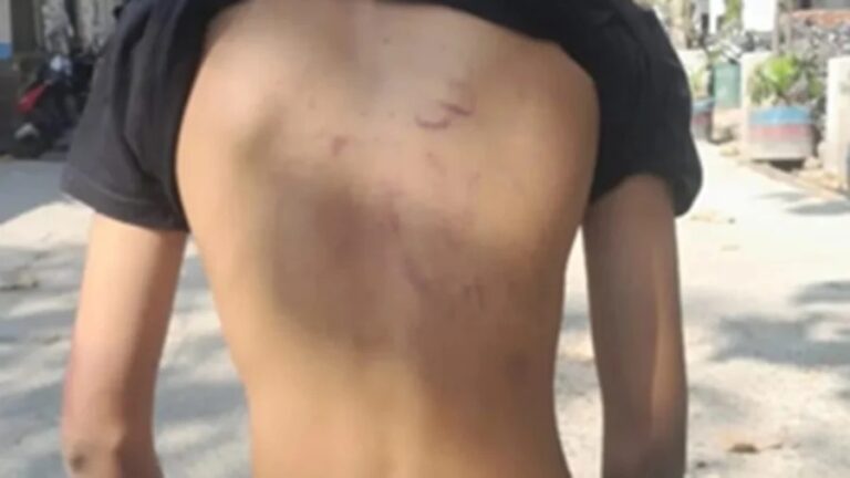 ಈದ್ ಶಾಪಿಂಗ್ ಮುಗಿಸಿ ಮನೆಗೆ ಮರಳುತ್ತಿದ್ದ ಮುಸ್ಲಿಂ ಬಾಲಕನ ಮೇಲೆ ಪೊಲೀಸರಿಂದ ಮಾರಣಾಂತಿಕ ಹಲ್ಲೆ: ವೀಡಿಯೋ ವೈರಲ್