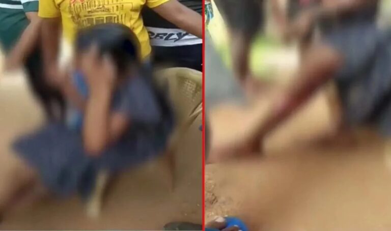 ದುಷ್ಕರ್ಮಿಗಳು ಅಪಹರಿಸಿ ಬೆಂಕಿ ಹಚ್ಚಿದ್ದ 15 ವರ್ಷದ ಬಾಲಕಿ ಸಾವು