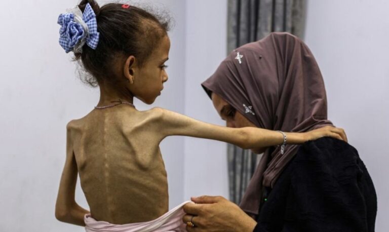 ಸತ್ತು ಹೋದ ಮಾನವೀಯತೆ: ಗಾಝಾದಲ್ಲಿ ಹಸಿವು, ಅಪೌಷ್ಠಿಕತೆಗೆ ಮತ್ತೆ 6 ಬಲಿ