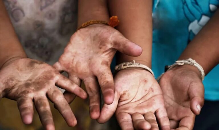 ದಿನಕ್ಕೆ 18 ಗಂಟೆ ಬಲವಂತವಾಗಿ ದುಡಿಸಿ, ಥಳಿಸುತ್ತಿದ್ದ ಮಾಲೀಕ : ಬಳೆ ಕಾರ್ಖಾನೆಯಿಂದ ತಪ್ಪಿಸಿಕೊಂಡ 7 ಮಕ್ಕಳು