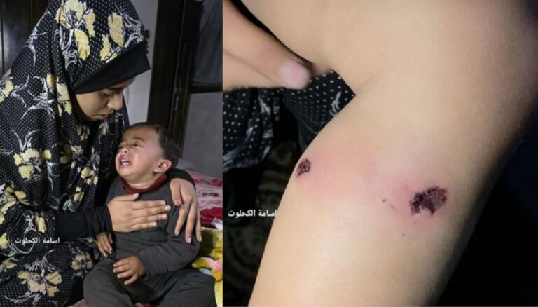 ಒಂದೂವರೆ ವರ್ಷದ ಪ್ಯಾಲೆಸ್ತೀನಿಯನ್ ಮಗುವಿಗೆ ಸಿಗರೇಟ್‌ನಿಂದ ಸುಟ್ಟು, ಮೊಳೆ ಚುಚ್ಚಿ ಚಿತ್ರಹಿಂಸೆ ಕೊಟ್ಟ ಇಸ್ರೇಲಿ ಸೈನಿಕರು